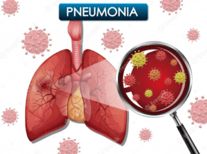 pneumonia in elderly